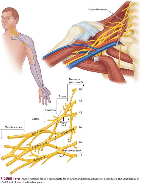 Upper Extremity Peripheral Nerve Blocks: Interscalene Block