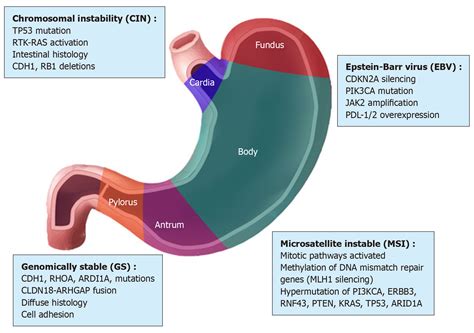 Gastric Cancer