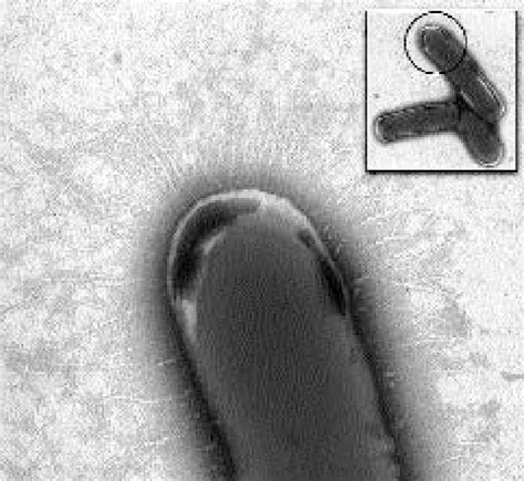 -An electron microscope view of a whole cell preparation of Actinomyces ...