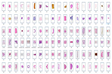 Human Ureter cross-section histology slides, 7 µm sec., H&E Stain ...