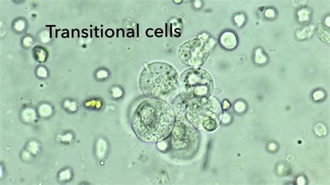 Renal Epithelial Cells In Urine