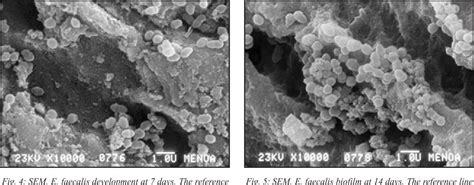 Figure 4 from Enterococcus Faecalis Biofilm. Formation and Development in Vitro Observed by ...