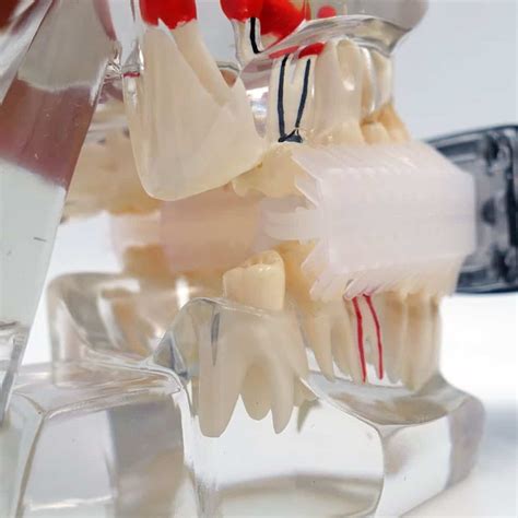 Mouthpiece Toothbrushes: Think Twice Before You Buy - Electric Teeth