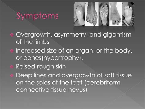 PPT - Proteus Syndrome PowerPoint Presentation - ID:3062719