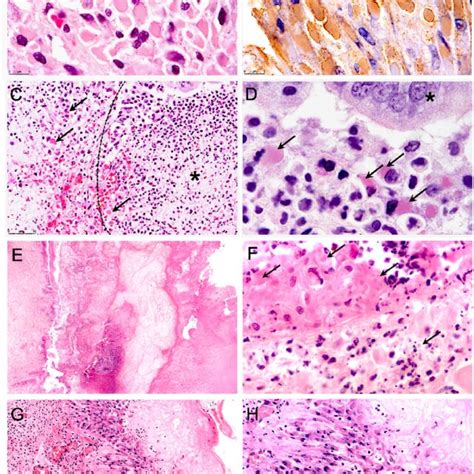 Lesion distribution and diagnostic features of cowpox in zoo and wild ...