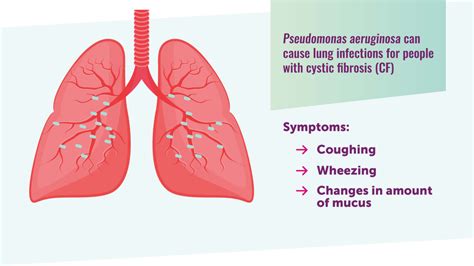 Pseudomonas Lung Infection