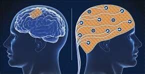 Neural Interfaces and Brain-Machine Interfaces