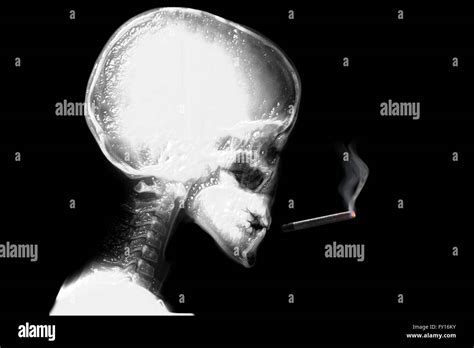 Skeleton smoking cigarette hi-res stock photography and images - Alamy