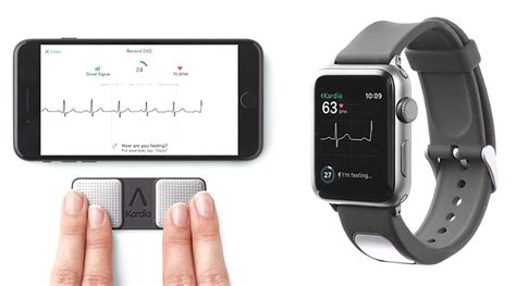 Innovation at ACC | Apple Watch ECG: A Useful Tool or Just Cool ...