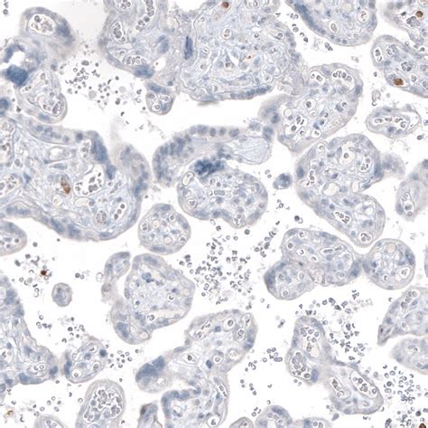 Mouse Monoclonal Anti-MUC2 Antibody - Buy for research - Highly ...