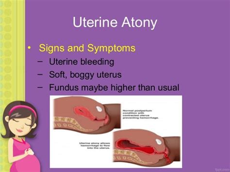 3rd stage of labor & abnormalities by liza tarca, md