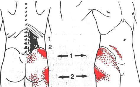 L2 – ChiroCOre