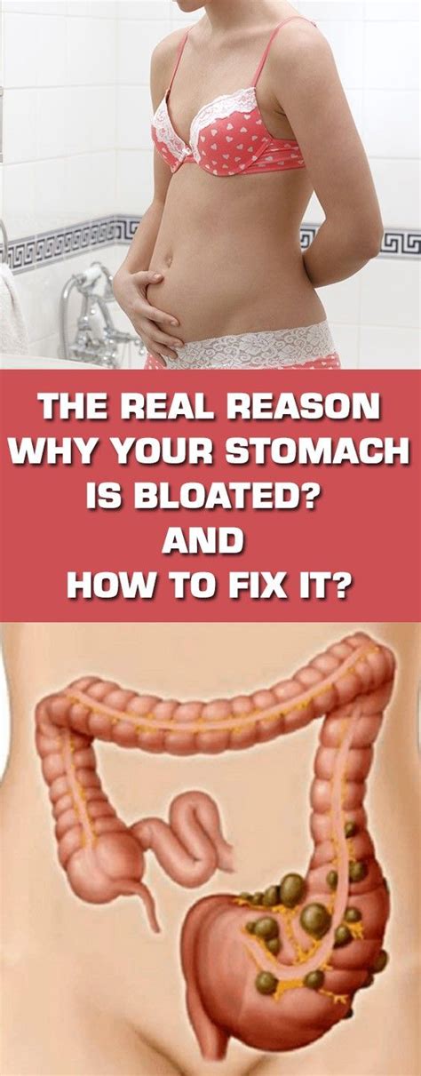 The Real Reason Why Your Stomach Is Bloated And How To Fix It | Abdominal bloating, Medical ...