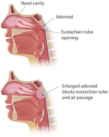 Eustachian Tube Pharynx