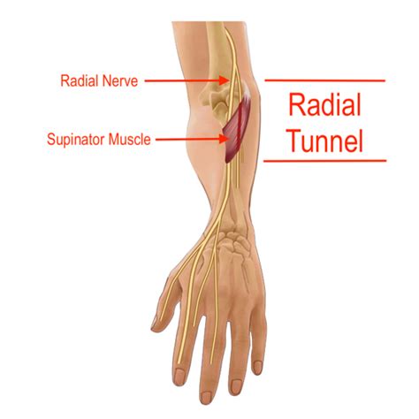 Radial Nerve Hand