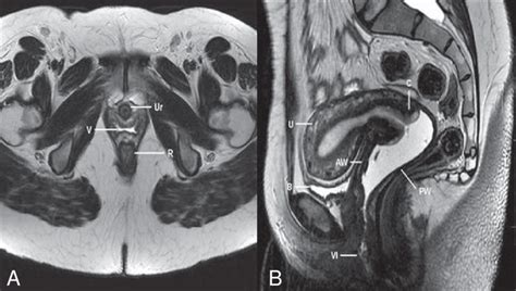 Mri Female Pelvis Anatomy Axial Image 22 Pelvis Anatomy Pelvis Anatomy | Images and Photos finder