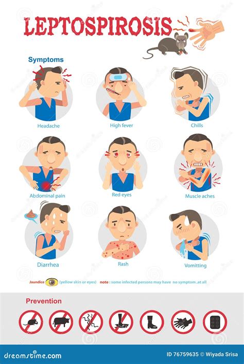 Leptospirosis stock vector. Illustration of conjunctivitis - 76759635