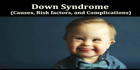 Down Syndrome (Causes, Risk factors, and Complications) - Assignment Point