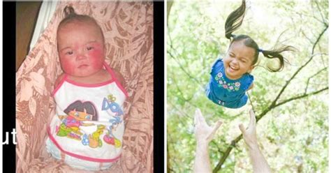 Heartwarming adoption story of Pinay kid born without limbs goes viral | The Summit Express