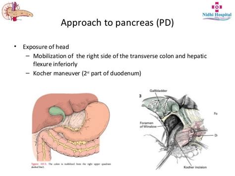 Resectional Anatomy of Pancreas