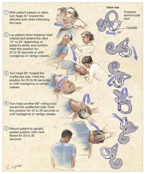 JAMA on Twitter | Physical therapy, Physical therapy exercises, Vertigo exercises