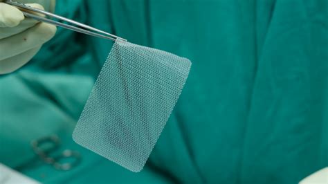 Hernia Mesh Surgery: Procedure, Types & Advantages | Meril Life