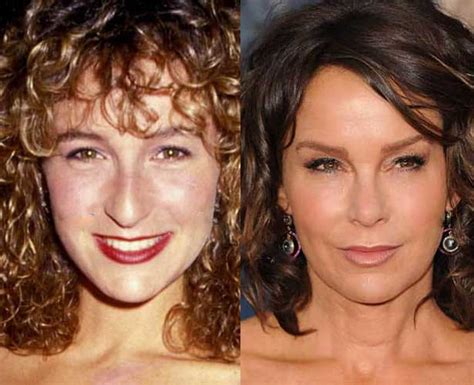 Jennifer Grey Plastic Surgery: Nose Job, Facelift, Botox