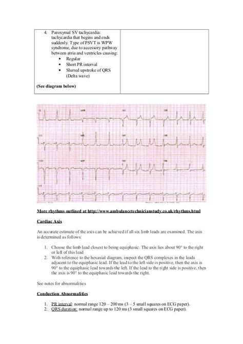 Beginners Guide for ECG Interpretation