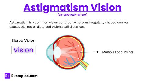 Astigmatism Vision - Examples, Types, Symptoms, Causes, Measurements