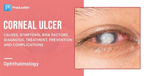 Corneal Ulcer: Causes, Symptoms, Risk Factors, Diagnosis, Treatment, Prevention and Complications