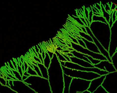 Hyperbranching of the fungus Neurospora crassa (bread mold) exposed to Latrunculin B | 2008 ...