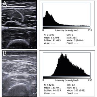 Muscle echogenicity in grayscale and histographic analysis in a healthy... | Download Scientific ...