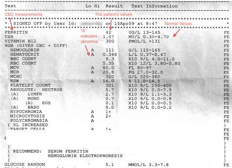 Example Resume: Example Cbc With Anemia