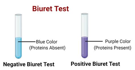 Biuret Test For Protein- Definition, Principle, Procedure, Results, Uses