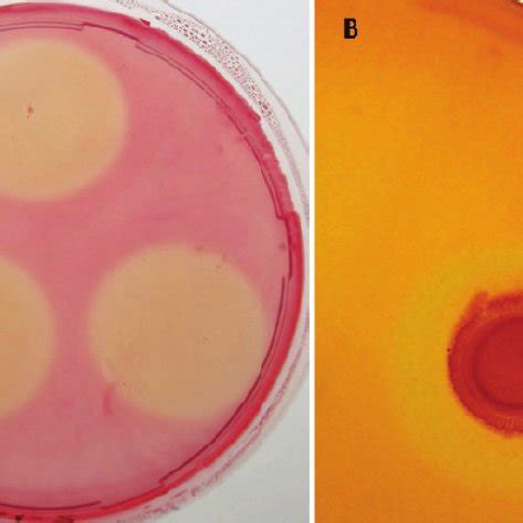 Congo red staining for HC value experiments of CB1-2 in MM-1%CMC agar... | Download Scientific ...