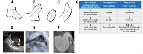 A new practical anatomical classification for left atrial appendage ...