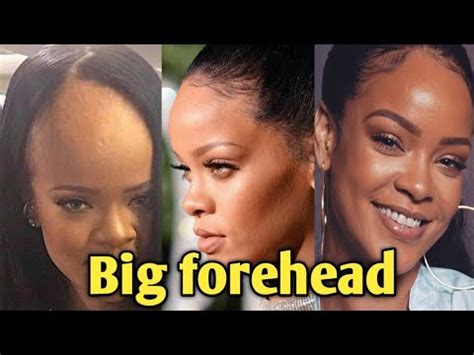 Big Forehead!. Find out how Rihanna hides her Huge Forehead. - YouTube