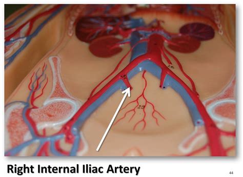 Right internal iliac artery - The Anatomy of the Arteries … | Flickr