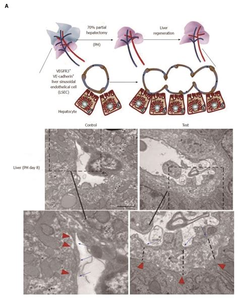 Pathological process of liver sinusoidal endothelial cells in liver ...