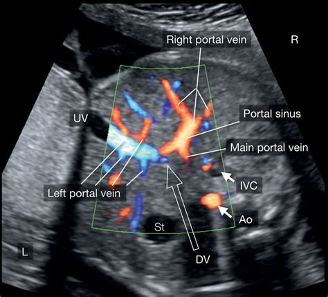 Right And Left Portal Vein Ultrasound