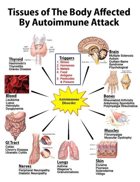 Lifestyle Factors and Dietary Interventions for Autoimmune Disease Genetic Optimization