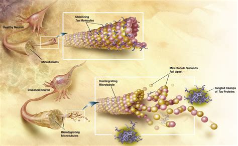 Unraveling the tangles in the Drosophila head - IndiaBioscience