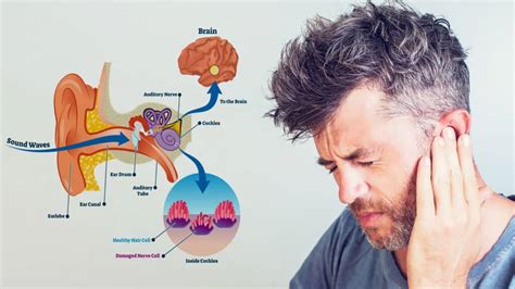 15 Causes of Ringing in the Ears (And How to Fix It)