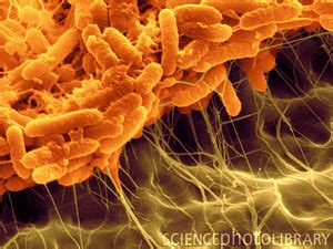 Serratia liquefaciens - microbewiki