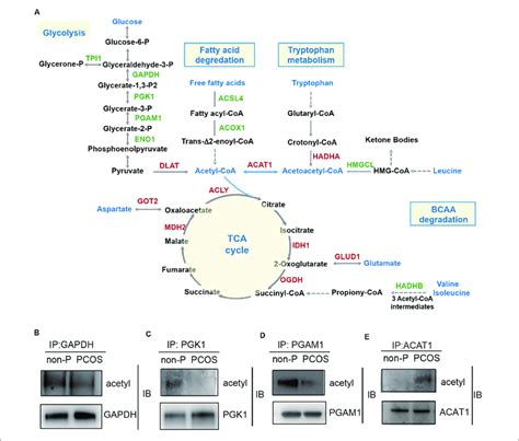 | Lysine acetylation of proteins regulates metabolic pathways in PCOS... | Download Scientific ...