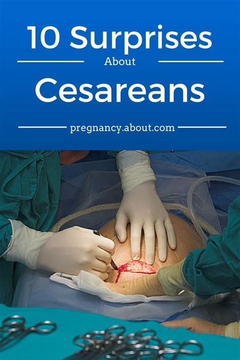 Pin on Cesarean and VBAC