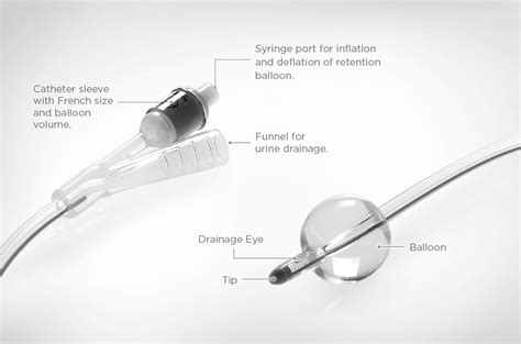 A Brief Introduction of Fortune Foley Balloon Catheter - Fortune Medical Instrument Corp.