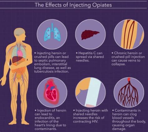 How Long Do Opiates Stay in Your System, Urine & Blood