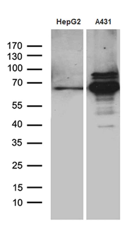 PCSK9 Antibody (CF811840)