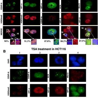 Abbreviations ACA: Anti-centromere antibody; CCAN: Constitutive... | Download Scientific Diagram